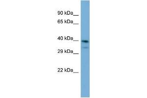 Host:  Rabbit  Target Name:  INPP5J  Sample Type:  Jurkat Whole Cell lysates  Antibody Dilution:  1. (INPP5J 抗体  (C-Term))