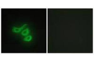 Immunofluorescence analysis of HepG2 cells, using M-CK antibody. (CKM 抗体  (N-Term))