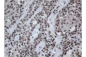 Image no. 1 for anti-Chromobox Homolog 8 (CBX8) (AA 1-260) antibody (ABIN1490663) (CBX8 抗体  (AA 1-260))