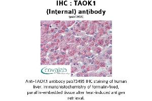 Image no. 2 for anti-TAO Kinase 1 (TAOK1) (Internal Region) antibody (ABIN1739900) (TAO Kinase 1 (TAOK1) (Internal Region) 抗体)