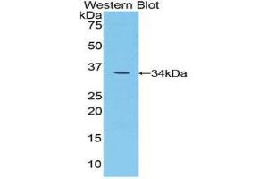 Western Blotting (WB) image for anti-serine Peptidase Inhibitor, Kazal Type 5 (SPINK5) (AA 734-995) antibody (ABIN1860612) (SPINK5 抗体  (AA 734-995))