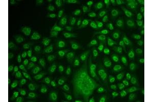 Immunofluorescence analysis of U2OS cell using TFPT antibody. (TFPT 抗体)