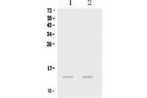 Western blot analysis of MIP-3 Alpha/CCL20 using anti-MIP-3 Alpha/CCL20 antibody . (CCL20 抗体  (AA 28-97))