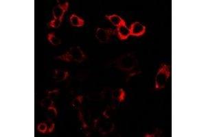 Immunofluorescence (IF) image for anti-Glutamate Receptor, Ionotropic, AMPA 3 (GRIA3) antibody (ABIN7307842)
