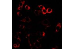 Immunofluorescent analysis of GLUR3 staining in U2OS cells. (Glutamate Receptor 3 抗体)