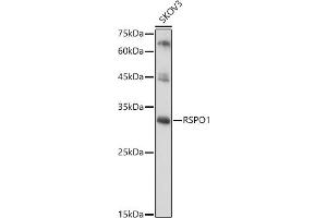 Western blot analysis of extracts of SKOV3 cells, using RSPO1 antibody (ABIN6132958, ABIN6147279, ABIN6147280 and ABIN6224304) at 1:1000 dilution. (RSPO1 抗体  (AA 21-263))