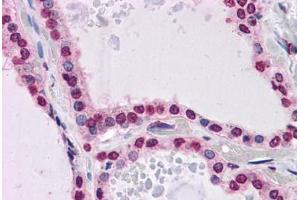 Human Thyroid: Formalin-Fixed, Paraffin-Embedded (FFPE) (KPNA7 抗体  (N-Term))