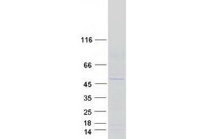 Western Blotting (WB) image for Kelch Domain Containing 3 (KLHDC3) protein (Myc-DYKDDDDK Tag) (ABIN2724303)