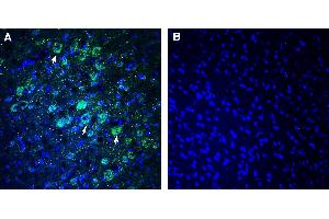 Expression of NEGR1 in rat parietal cortex Immunohistochemical staining of perfusion-fixed frozen rat brain sections with Anti-NEGR1 (extracellular) Antibody (ABIN7581917), (1:300), followed by goat anti-rabbit-AlexaFluor-488. (NEGR1 抗体  (Extracellular))