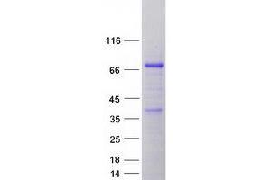 Western Blotting (WB) image for Sphingomyelin Phosphodiesterase 3 (SMPD3) protein (Myc-DYKDDDDK Tag) (ABIN2732261)
