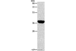 Western blot analysis of Mouse liver tissue, using ALDOB Polyclonal Antibody at dilution of 1:200 (ALDOB 抗体)