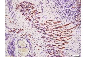 Formalin-fixed and paraffin embedded mouse embryo muscle labeled with Anti-TXLNB Polyclonal Antibody, Unconjugated (ABIN1386717) at 1:200, followed by conjugation to the secondary antibody and DAB staining (Taxilin beta 抗体  (AA 331-430))