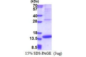 SDS-PAGE (SDS) image for Melanoma Inhibitory Activity (MIA) (AA 25-131) protein (His tag) (ABIN5853463) (MIA Protein (AA 25-131) (His tag))