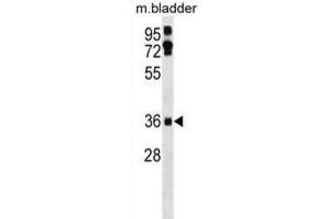 Western Blotting (WB) image for anti-Etoposide Induced 2.4 (EI24) antibody (ABIN3000878) (EI24 抗体)