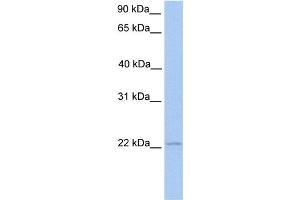 WB Suggested Anti-ISG20 Antibody Titration:  0. (ISG20 抗体  (Middle Region))