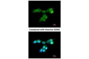 ICC/IF Image Immunofluorescence analysis of paraformaldehyde-fixed A431, using DUSP10, antibody at 1:200 dilution. (DUSP10 抗体  (C-Term))