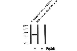 Western blot analysis of extracts of HT-29 cells treated with hTNF/Z-VAD/SM-164 , using Phospho-RIP (Ser166) Antibody .