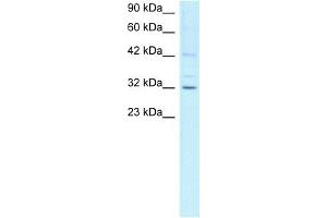 WB Suggested Anti-CCNH Antibody Titration:  1ug/ml  Positive Control:  Jurkat cell lysate CCNH is supported by BioGPS gene expression data to be expressed in Jurkat (Cyclin H 抗体  (C-Term))