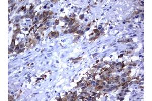 Image no. 4 for anti-Mdm2, p53 E3 Ubiquitin Protein Ligase Homolog (Mouse) (MDM2) (AA 119-438) antibody (ABIN1490872) (MDM2 抗体  (AA 119-438))