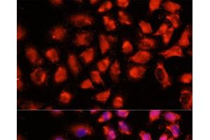 Immunofluorescence analysis of HeLa cells using ADAM8 Polyclonal Antibody at dilution of 1:100 (40x lens). (ADAM8 抗体)