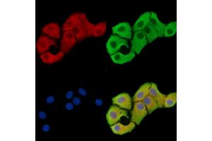 ABIN7096518 and ABIN7100582 staining Hela cells by IF/ICC. (OSBPL11 抗体)