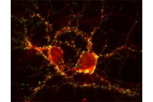 Immunocytochemistry (ICC) image for anti-SynCAM 1/2/3 (AA 436-446) antibody (ABIN1742491) (SynCAM 1/2/3 (AA 436-446) 抗体)