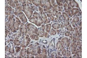 Image no. 1 for anti-Mitogen-Activated Protein Kinase Kinase 3 (MAP2K3) antibody (ABIN1499403) (MAP2K3 抗体)