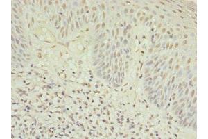 Immunohistochemistry of paraffin-embedded human tonsil tissue using ABIN7174944 at dilution of 1:100 (Myosin IC 抗体  (AA 804-1063))