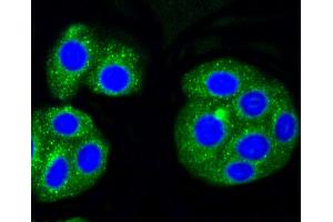 HepG2 cells were stained with Alas1 (1G11) Monoclonal Antibody  at 1:200 in PBS and incubated for overnight at 4C, followed by secondary antibody incubation, DAPI staining of the nuclei and detection (ALAS1 抗体)