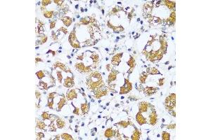 Immunohistochemistry (IHC) image for anti-ATP Synthase, H+ Transporting, Mitochondrial F0 Complex, Subunit E (ATP5I) (AA 1-69) antibody (ABIN7265720)