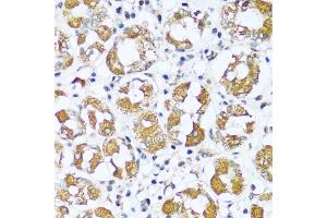 Immunohistochemistry of paraffin-embedded human stomach using I antibody (ABIN7265720) at dilution of 1:100 (40x lens).