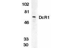 Western blot analysis of DcR1 in HeLa whole cell lysate with DcR1 antibody at 1 g/ml. (DcR1 抗体)