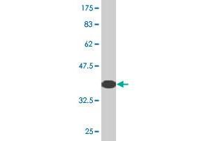 Western Blot detection against Immunogen (36. (Kelch-like protein 41 (KLHL41) (AA 205-304) 抗体)