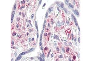 IHC analysis of FFPE human placenta tissue stained with IRAK antibody