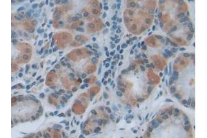 IHC-P analysis of Human Stomach Tissue, with DAB staining. (MYD88 抗体  (AA 32-265))