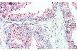Detection of TNFaIP6 in Human Prostate Tissue using Polyclonal Antibody to Tumor Necrosis Factor Alpha Induced Protein 6 (TNFaIP6) (TNFAIP6 抗体  (AA 18-275))