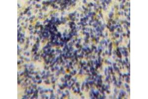 Used in DAB staining on fromalin fixed paraffin-embedded Spleen tissue (CCL24 抗体  (AA 27-119))