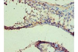 Immunohistochemistry (IHC) image for anti-Isocitrate Dehydrogenase 1 (NADP+), Soluble (IDH1) (AA 1-240) antibody (ABIN6097760)
