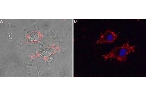 Expression of CaVγ5 (CACNG5) in living rat PC12 cells - Cell surface detection of CaVγ5 (CACNG5) in intact living rat PC12 cells using Anti-CACNG5 (extracellular) Antibody (ABIN7042993, ABIN7044061 and ABIN7044062), (1:25) followed by goat anti-rabbit-AlexaFluor-594 secondary antibody.