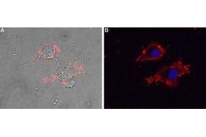 Expression of CaVγ5 (CACNG5) in living rat PC12 cells - Cell surface detection of CaVγ5 (CACNG5) in intact living rat PC12 cells using Anti-CACNG5 (extracellular) Antibody (ABIN7042993, ABIN7044061 and ABIN7044062), (1:25) followed by goat anti-rabbit-AlexaFluor-594 secondary antibody. (CACNG5 抗体  (1st Extracellular Loop))