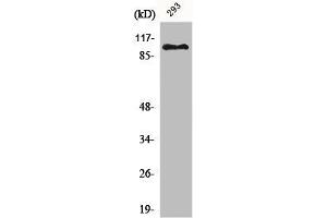 Western Blot analysis of 293 cells using ERCC4 Polyclonal Antibody (ERCC4 抗体  (C-Term))