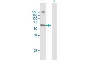 Western Blot analysis of MYCN expression in transfected 293T cell line by MYCN MaxPab polyclonal antibody. (MYCN 抗体  (AA 1-464))