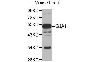 Western blot analysis of extracts of mouse heart, using GJA1 antibody. (Connexin 43/GJA1 抗体  (AA 233-382))