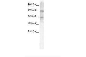 Image no. 1 for anti-Potassium Voltage-Gated Channel, Shal-Related Subfamily, Member 3 (KCND3) (AA 424-473) antibody (ABIN202843) (KCND3 抗体  (AA 424-473))