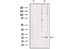 Western blot analysis of extracts from rat brain, using TRAPPC5 Antibody. (TRAPPC5 抗体  (Internal Region))