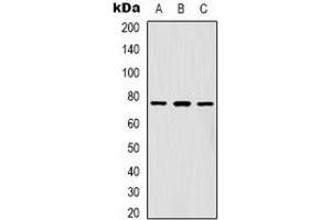 Western blot analysis of FOXK1 expression in Hela (A), A431 (B), Jurkat (C) whole cell lysates. (Foxk1 抗体  (C-Term))