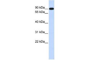 ZXDA antibody used at 0. (ZXDA 抗体  (Middle Region))