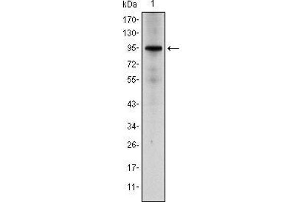 Glucocorticoid Receptor 抗体