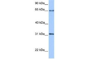 WB Suggested Anti-ZNF394 Antibody Titration:  0. (ZNF394 抗体  (N-Term))