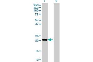 Western Blot analysis of MS4A4A expression in transfected 293T cell line by MS4A4A MaxPab polyclonal antibody. (MS4A4A 抗体  (AA 1-220))